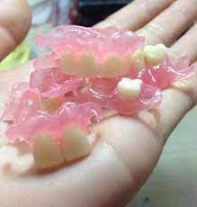 These dentures produce high aesthetic results and blend in with your natural. Amazon Com Affordable Flexible Valplast Customized Partial Denture Pink Valplast Industrial Scientific