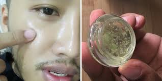 Wajah adalah mencerminkan diri anda. Rahsia Kulit Jadi Flawless Bak Putih Telur Perkongsian Lelaki Ini Dikongsi Hampir 25k Netizen Hijabista