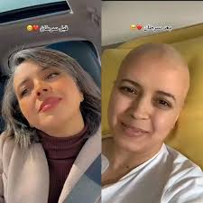 SUN RISE لجميع أعمال الطاقة الشمسية الكلاكلة