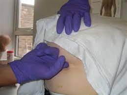 Rectal (Pr) Examination — Medistudents