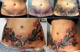 It is a major cosmetic surgical treatment and has to be carried out by the best cosmetic surgeon. Tattoo Over Tummy Tuck Feminine Tummy Tuck Tattoo