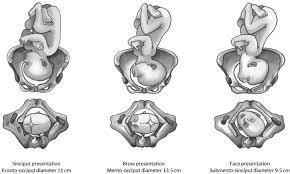 Image result for Face Presentation