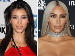 So, did kim k go under the knife? Kim Kardashian Before And After The Skincare Edit