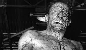 The 25 Worst, Bloodiest Cuts in Boxing History - Part 2 of 2