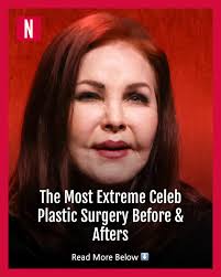 Celebrity plastic surgery before and afters can be extreme, take Katie  Price, Bobby Norris, Priscilla Presley, and many more as examples.