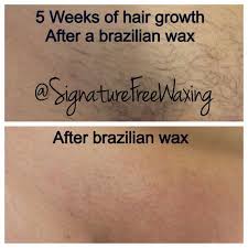 Top Photos 5 Weeks Of Hair Growth After Receiving A Brazilian Wax At Signature Free Waxing Bottom Photo After Receivi Brazilian Waxing Hair Growth Top Photo