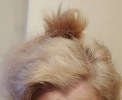 This is a little darker than our platinum you can cut them and wash them, but since they are synthetic hair, they cannot be colored/dyed. Orange Hair Misadventures In Going Natural From Dark Brown Part Iv With Christian Eyes