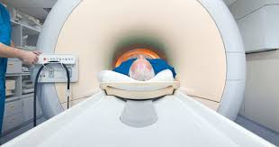 02.02.2018 · fractional volumes of prostatic lumen, stroma, and epithelium change significantly when cancer is present. Psa Here S Your Competition For Prostate Cancer Screening Medpage Today