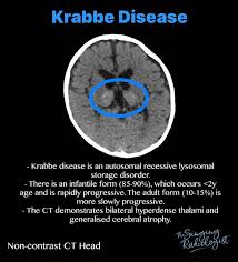 Pin On Neuroradiologie