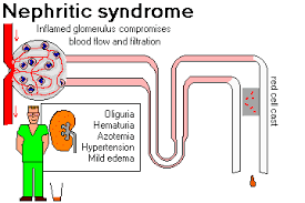Pin On Kidneys