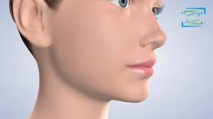 Post-Operative Instructions: General Non-Oral in Fresno CA