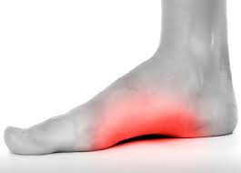 One common type of foot pain you may experience is outer foot pain. Foot Arch Pain Causes Treatment Foot Pain Explored