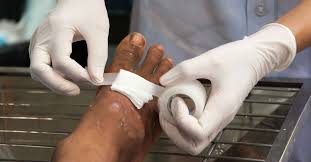 You should speak to your physician about his post operative healing regimen. What S All The Fuss About Wound Dressing Change Frequency Wcei