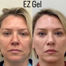 𝗦𝗮𝗿𝗮 𝗞𝗼𝗼𝗽, MSN RN (@sara_spaderma) • Instagram photos and videos