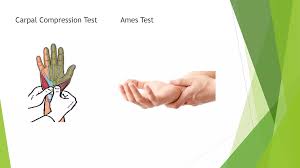 Image result for Carpal Compression Test