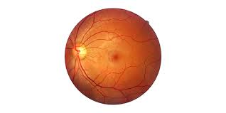 Retinal detachment is a serious eye condition that happens when your retina pulls away from the tissue around it. Retinal Detachment Surgery Diagnosis And Treatment Centre For Sight