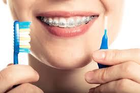 Get rid of stains & smears from butter, gravy, or cooking oils. The Pros And Cons Of Ceramic Braces Orange Coast Orthodontics Orthodontist Laguna Hills Ca