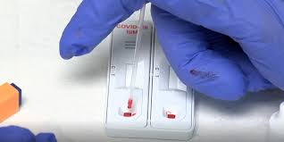 Lot of manufacturers offer poc cassette rapid tests, detecting antibodies (ab). Covid 19 Rapid Antibody Tests Available At Kroger Pharmacies