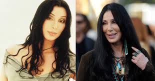 Now, cosmetic and reconstructive procedures are quite common, and many do not even require invasive measures. Top 25 Most Expensive Celebrity Plastic Surgeries