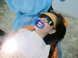Whitening with Tooth Angels