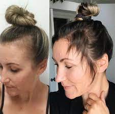 By now, hair loss may have considerably slowed or stopped, and some people may see signs of regrowth (usually at the crown of the head). Monat For Post Partum Hairloss Monat Hair Loss Monat Hair Hair Treatment Thinning