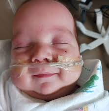 Removing Tubal Clips Is A Success💕 Premature But Coming A Long Way!👶 He  was born at 26 weeks 5 days. He was 2 lbs. 12 oz. He went through a very big