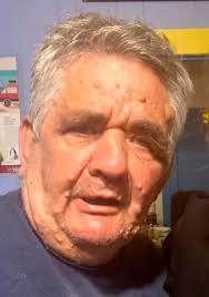 Jacob “Dale” Hamm