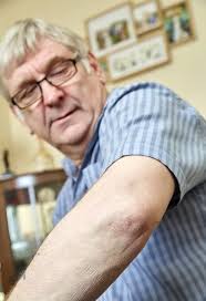 I've done the operation wrong' Surgeon tells recovering patient at bedside  that he's reported himself to medical watchdogs