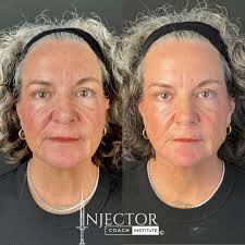 Injector Coach Institute