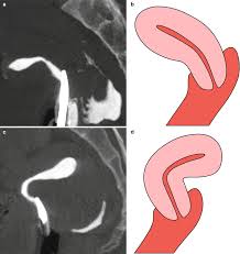 Image result for cervix position