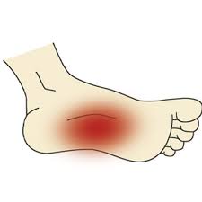 Pin On Health