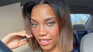 The Reason This Model's Unusual Cosmetic Surgery Is Going Viral