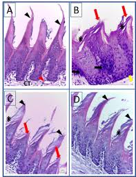 Image result for Filiform Papillae
