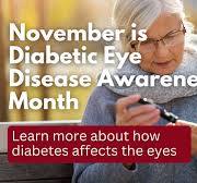 Eye Doctors 眼科医生 in California | Golden Vision Optometry