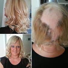 We have over 7 years of experience with various hair extensions, including tape hair extensions, micro beads. Mesh Integration Hair Replacement