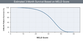 Image result for MELD Score