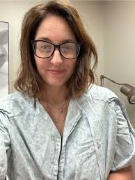 Can facial drooping caused by AVM embolization be corrected with Botox?