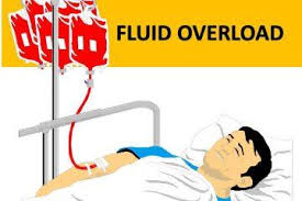 Image result for Transfusion Associated Circulatory Overload