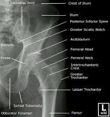 The space or compartment surrounded by the pelvic girdle (bony pelvis). Pelvis Anterior Posterior X Ray Www Anatomynote Com Radiology Student Radiology Technologist Anatomy