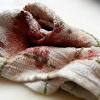 The hemoglobin in the blood and other coagulating factors cause it to. Https Encrypted Tbn0 Gstatic Com Images Q Tbn And9gcsnj Zyofs8qhm5bmpssj 6ywzrmkxrcbd5drosp96kqpi9i Zm Usqp Cau