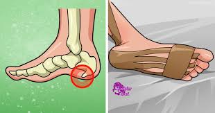 Deneyen Herkes Memnun Bone Spurs Running Sport Shoes Home Remedies