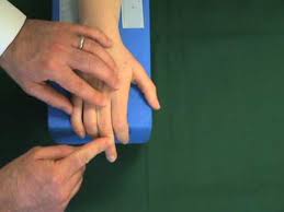 Image result for Elson Extensor Tendon Test