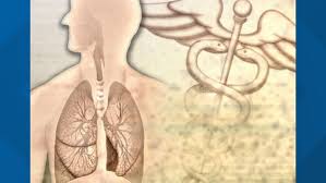 Most of these symptoms are more likely to be caused by something other than lung cancer. Should You Have A Lung Cancer Screening Wfmynews2 Com