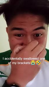 Nalunok konung bracket ko, sisigaw na ba ako ng darna?😭😭 #braces  #brackets #accidentally #foryoupage #fyp #fypシ