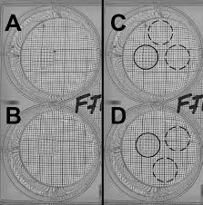 Not only it provides 8.5 x 11 paper founder of lifehack read full profile one of the most popular site recently (within del. Typical Photographs Of Lenses In Culture Dishes Showing Graph Paper Download Scientific Diagram