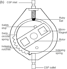 We did not find results for: Hydrocephalus Shunts Chapter 17 Adult Hydrocephalus
