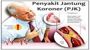 Jantung merupakan organ vital yang berfungsi untuk memompa dan mengalirkan darah ke seluruh tubuh, sehingga organ dan jaringan tubuh dapat menjalankan fungsinya dengan baik. Jenis Penyakit Jantung Itu Banyak Inilah Jenis Penyakit Jantung Yang Paling Umum Halaman All Sriwijaya Post