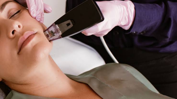 The Morpheus Enhance Treatment - Dr Nerina Wilkinson + Associates