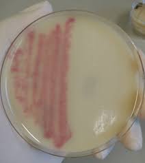 A vaccination was the cause of this infection. Methicillin Resistant Staphylococcus Aureus Wikipedia