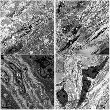 Animal cell transmission electron microscope images. Ultrastructural Identification Of Telocytes In The Muscularis Of Chicken Ileum
